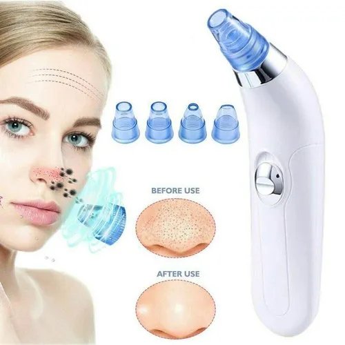 Derma Suction Blackhead Acne Oil Remover Vacuum Suction Face Pore Cleaner Facial Beauty Equipment!